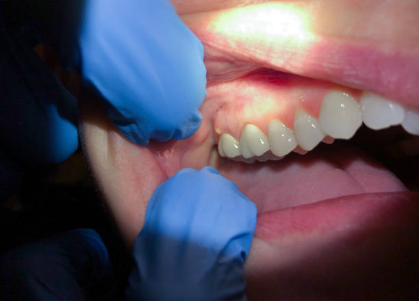 Best Same-Day Emergency Dental Services in Ludowici, GA