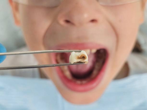 Best Emergency Dental Care for Broken or Chipped Teeth in Ludowici, GA